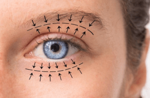 Blépharoplastie Docteur Garcia