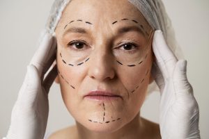 Lipofilling Docteur Garcia